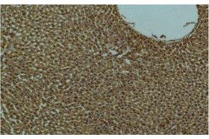 Immunohistochemistry of paraffin-embedded Rat liver tissue using PI 3 kinase p85 alpha Monoclonal Antibody at dilution of 1:200. (PIK3R1 抗体)