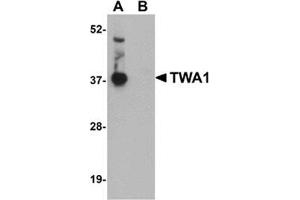 Western blot analysis of TWA1 in human brain tissue lysate with this product at 1 μg/ml in (A) the absence and (B) the presence of blocking peptide.