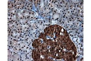 Immunohistochemical staining of paraffin-embedded colon tissue using anti-ACLY mouse monoclonal antibody. (ACLY 抗体)