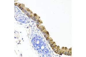 Immunohistochemistry of paraffin-embedded mouse lung using TOPBP1 antibody. (TOPBP1 抗体)