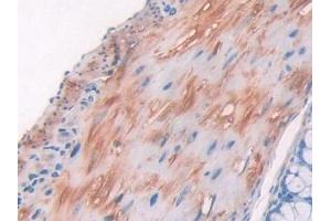 Immunohistochemistry (IHC) image for anti-Collagen, Type II, alpha 1 (COL2A1) (AA 1307-1383) antibody (ABIN7438682)