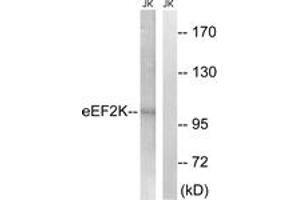 Western blot analysis of extracts from Jurkat cells, using eEF2K (Ab-359) Antibody. (EEF2K 抗体  (AA 336-385))