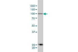 ARTS-1 monoclonal antibody (M01), clone 4H8 Western Blot analysis of ARTS-1 expression in A-431 . (ERAP1 抗体  (AA 832-941))