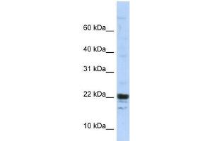 KIAA0040 antibody used at 5 ug/ml to detect target protein. (KIAA0040 抗体  (Middle Region))