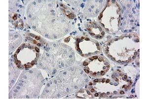 Immunohistochemical staining of paraffin-embedded Human Kidney tissue using anti-BECN1 mouse monoclonal antibody. (Beclin 1 抗体)