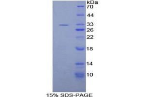 SDS-PAGE analysis of Human IL20Rb Protein. (IL20RB 蛋白)