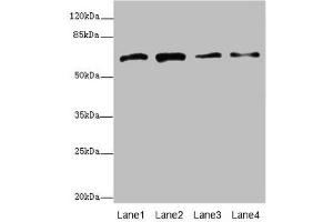 Western blot All lanes: GALNT2 antibody at 4. (GALNT2 抗体  (AA 442-571))