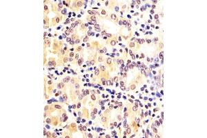 (ABIN6242334 and ABIN6578174) staining FN3KRP in human Stomach sections by Immunohistochemistry (IHC-P - paraformaldehyde-fixed, paraffin-embedded sections). (FN3KRP 抗体  (AA 24-58))