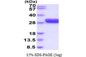 SDS-PAGE (SDS) image for Oxidized Low Density Lipoprotein (Lectin-Like) Receptor 1 (OLR1) (AA 58-273) protein (His tag) (ABIN5854750) (OLR1 Protein (AA 58-273) (His tag))