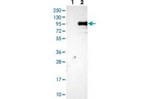 Western blot analysis of Lane 1: Negative control (vector only transfected HEK293T lysate), Lane 2: Over-expression Lysate (Co-expressed with a C-terminal myc-DDK tag (~3. (KIAA1586 抗体)