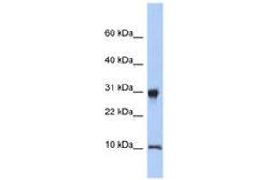Image no. 1 for anti-Ribosomal Protein S21 (RPS21) (N-Term) antibody (ABIN6744006) (RPS21 抗体  (N-Term))