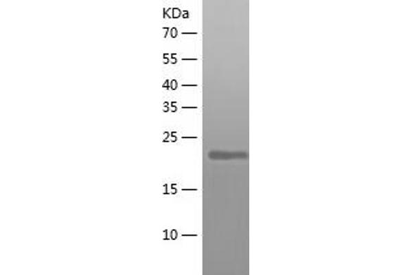 DTD1 Protein (AA 1-209) (His tag)