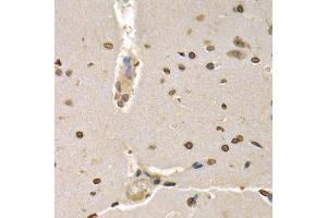 Immunohistochemistry of paraffin-embedded rat brain using HIST4H4 antibody (ABIN5970479) at dilution of 1/200 (40x lens). (HIST4H4 抗体)