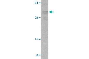 Western blot analysis of PIGY in A-20 cell lysate with PIGY polyclonal antibody  at 2 ug/mL . (PIGY 抗体  (C-Term))