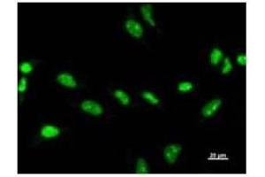 Immunostaining analysis in HeLa cells. (ZSCAN21 抗体)