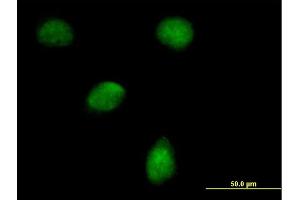 Immunofluorescence of purified MaxPab antibody to EGLN3 on HeLa cell.