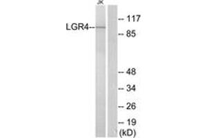 Western blot analysis of extracts from Jurkat cells, using LGR4 Antibody. (LGR4 抗体  (AA 461-510))