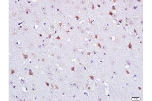 Paraformaldehyde-fixed, paraffin embedded mouse brain tissue, Antigen retrieval by boiling in sodium citrate buffer(pH6) for 15min, Block endogenous peroxidase by 3% hydrogen peroxide for 30 minutes, Blocking buffer (normal goat serum) at 37°C for 20min, Antibody incubation with Rabbit Anti-CNG Channel beta 1 Polyclonal Antibody, Unconjugated  at 1:400 overnight at 4°C, followed by a conjugated secondary and DAB staining (CNG Channel beta 1/truncated GARP (AA 851-950) 抗体)