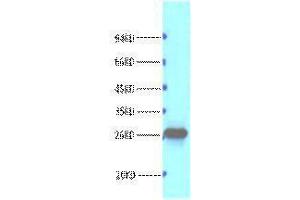 Western Blotting (WB) image for anti-B-Cell CLL/lymphoma 2 (BCL2) antibody (ABIN3181112) (Bcl-2 抗体)