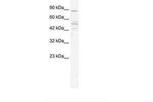 Image no. 1 for anti-Cholinergic Receptor, Nicotinic, beta 2 (Neuronal) (CHRNB2) (AA 156-205) antibody (ABIN202672) (CHRNB2 抗体  (AA 156-205))
