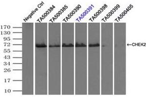 Image no. 1 for anti-Checkpoint Kinase 2 (CHEK2) antibody (ABIN1497499) (CHEK2 抗体)