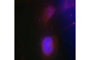 Immunofluorescence staining of methanol-fixed HeLa cells using BRCA1 (phospho-Ser988) antibody (E011237, Red) (BRCA1 抗体  (pSer988))