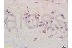 Formalin-fixed and paraffin embedded human placenta tissue labeled with Anti-CSIG Polyclonal Antibody, Unconjugated (ABIN728248) at 1:200 followed by conjugation to the secondary antibody and DAB staining (RSL1D1 抗体  (AA 151-250))