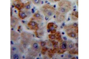 Used in DAB staining on fromalin fixed paraffin-embedded Liver tissue (IGLL1 抗体  (AA 112-206))