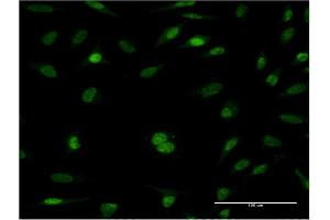 Immunofluorescence of monoclonal antibody to RFC5 on HeLa cell. (RFC5 抗体  (AA 1-340))
