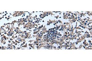 Immunohistochemistry of paraffin-embedded Human tonsil tissue using APOD Polyclonal Antibody at dilution of 1:55(x200) (Apolipoprotein D 抗体)
