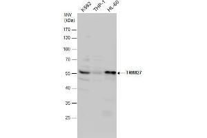 Western Blotting (WB) image for anti-Tripartite Motif Containing 27 (TRIM27) antibody (ABIN2855268)