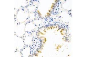 Immunohistochemistry of paraffin-embedded mouse lung using KLK11 antibody at dilution of 1:100 (40x lens). (Kallikrein 11 抗体)