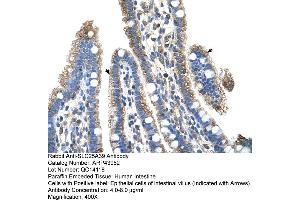 Human Intestine (SLC25A39 抗体  (C-Term))