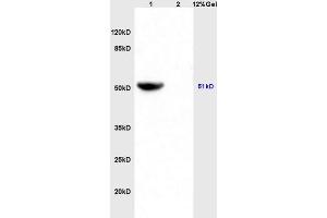 Lane 1: mouse heart lysates Lane 2: mouse brain lysates probed with Anti IDH2 Polyclonal Antibody, Unconjugated (ABIN751558) at 1:200 in 4 °C. (IDH2 抗体  (AA 251-350))