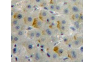 IHC-P analysis of Liver tissue, with DAB staining. (Insulin Receptor 抗体  (AA 1024-1298))