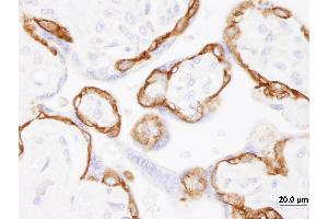 Immunohistochemistry (IHC) image for anti-Epidermal Growth Factor Receptor (EGFR) (C-Term) antibody (ABIN7448958)