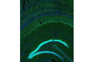 Indirect immunostaining of PFA fixed mouse brain section (dilution 1 : 200; green). (BCL11B 抗体)