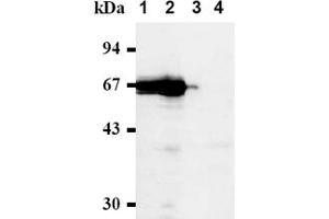 Western Blotting (WB) image for anti-Cell Division Cycle 7 (CDC7) antibody (ABIN487481) (CDC7 抗体)