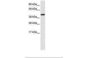 Image no. 1 for anti-CCR4-NOT Transcription Complex, Subunit 2 (CNOT2) (AA 112-161) antibody (ABIN202350) (CNOT2 抗体  (AA 112-161))