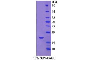 Image no. 1 for CD7 (CD7) (AA 26-134) protein (T7 tag,His tag) (ABIN6238898) (CD7 Protein (CD7) (AA 26-134) (T7 tag,His tag))