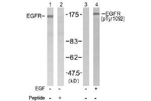 Image no. 2 for anti-Epidermal Growth Factor Receptor (EGFR) (Tyr1092) antibody (ABIN197230) (EGFR 抗体  (Tyr1092))