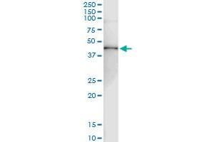 Immunoprecipitation of RRM2 transfected lysate using anti-RRM2 MaxPab rabbit polyclonal antibody and Protein A Magnetic Bead , and immunoblotted with RRM2 purified MaxPab mouse polyclonal antibody (B01P) . (RRM2 抗体  (AA 1-389))
