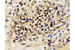 IHC analysis of EXOSC3 using anti-EXOSC3 antibody (ABIN7602216). (EXOSC3 抗体  (AA 64-275))