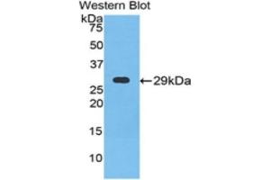 Western Blotting (WB) image for anti-Neuronal Pentraxin 1 (NPX1) (AA 146-384) antibody (ABIN1860045) (NPX1 抗体  (AA 146-384))