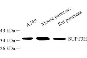 SUPT3H/SPT3 anticorps