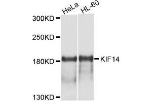 Western blot analysis of extract of HeLa and HL-60 cells, using KIF14 antibody. (KIF14 抗体)