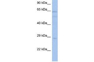 PRKAA1 antibody used at 1 ug/ml to detect target protein. (PRKAA1 抗体  (Middle Region))