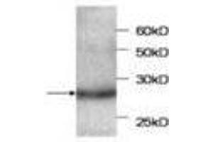 Image no. 1 for anti-serpin Peptidase Inhibitor, Clade B (Ovalbumin), Member 4 (SERPINB4) antibody (ABIN791516) (SERPINB4 抗体)