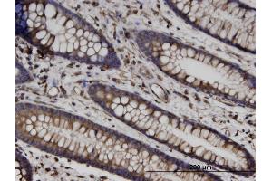 Immunoperoxidase of monoclonal antibody to TUBB on formalin-fixed paraffin-embedded human colon. (TUBB 抗体  (AA 1-444))
