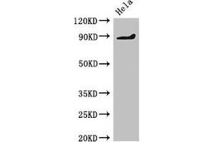Western Blot Positive WB detected in: Hela whole cell lysate All lanes: PDE2A antibody at 2 μg/mL Secondary Goat polyclonal to rabbit IgG at 1/50000 dilution Predicted band size: 106, 104, 105, 79, 88 kDa Observed band size: 88 kDa (PDE2A 抗体  (AA 15-226))
